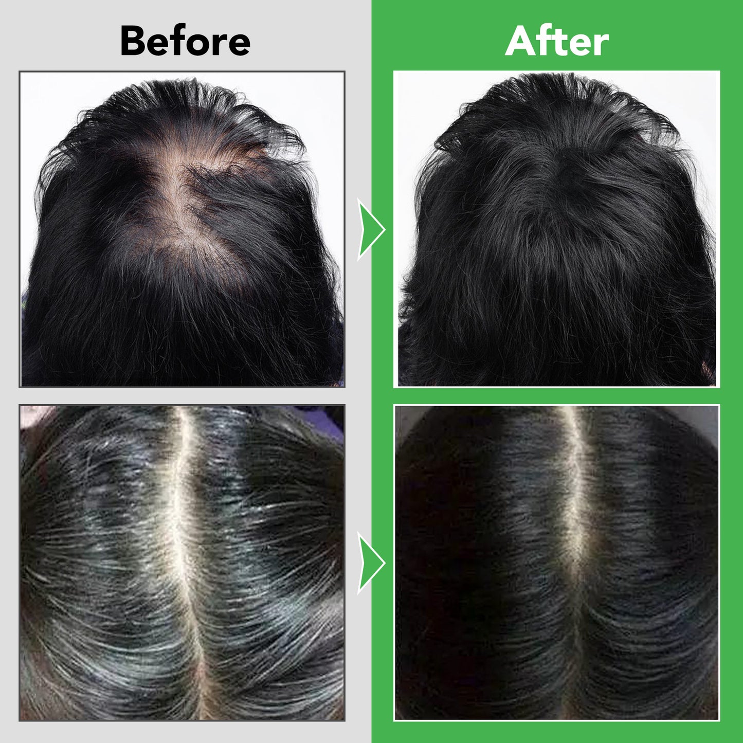 Aliver Rosemary Shampoo with Infused Biotin and Castor oil Hair Growth Treatment