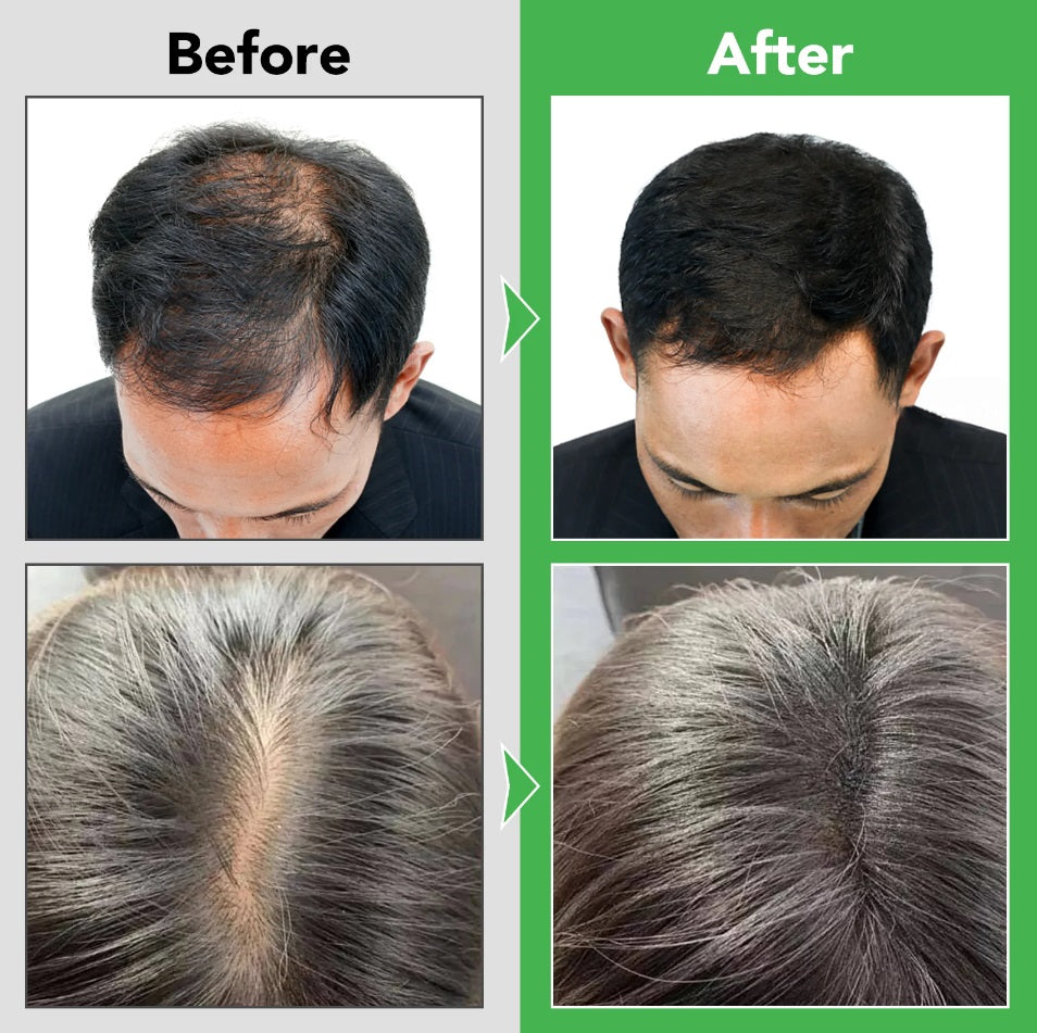 Aliver Rosemary Shampoo with Infused Biotin and Castor oil Hair Growth Treatment