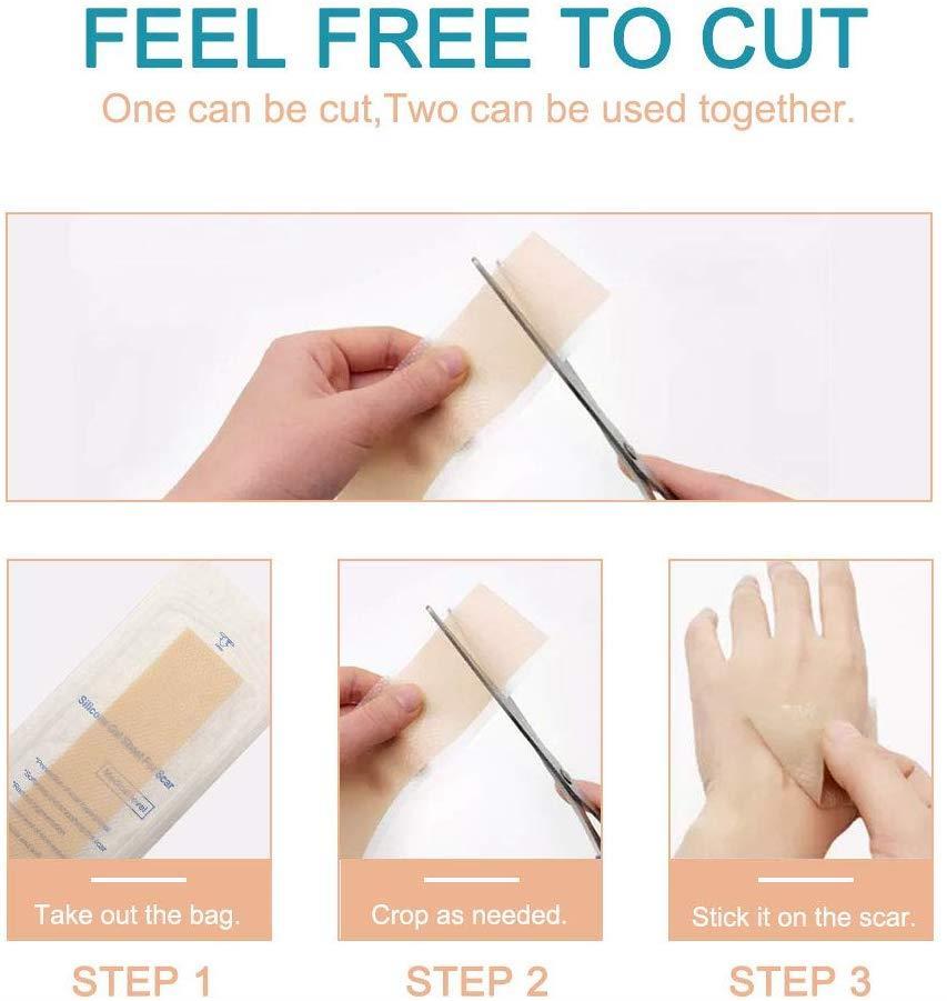 Aliver Silicone Scar Removal Treatment Sheets 4pcs