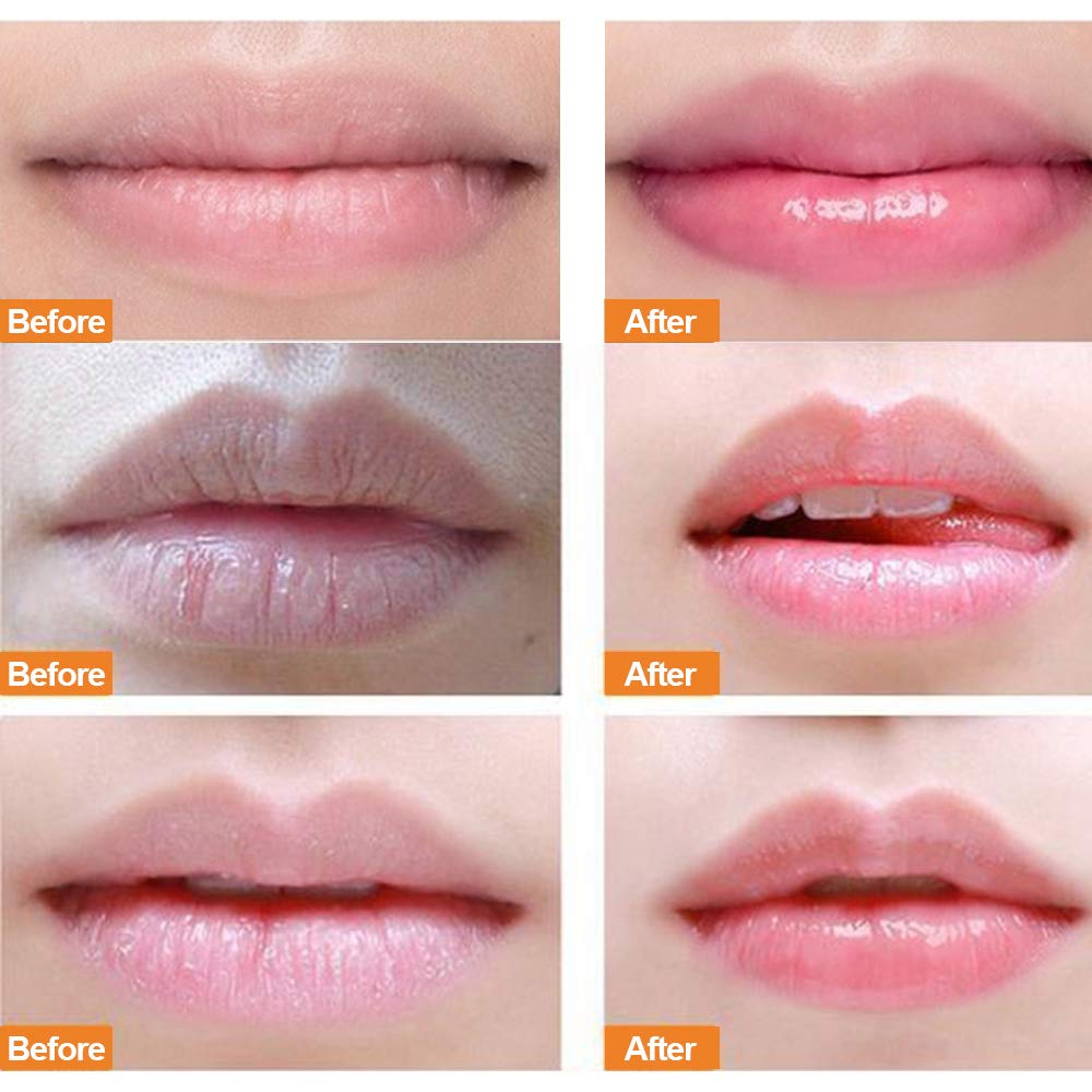 Aliver Double-Effect Lip Sleep Mask with Collagen Peptide, Lip Mask & Lip Scrub Intensive Moisturizing Lip Repair Treatment