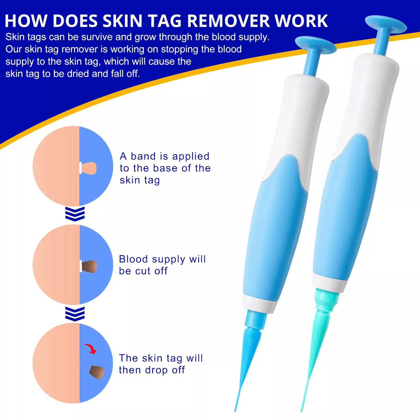 Aliver 2 in 1 Painless Skin Tag Remover Pen