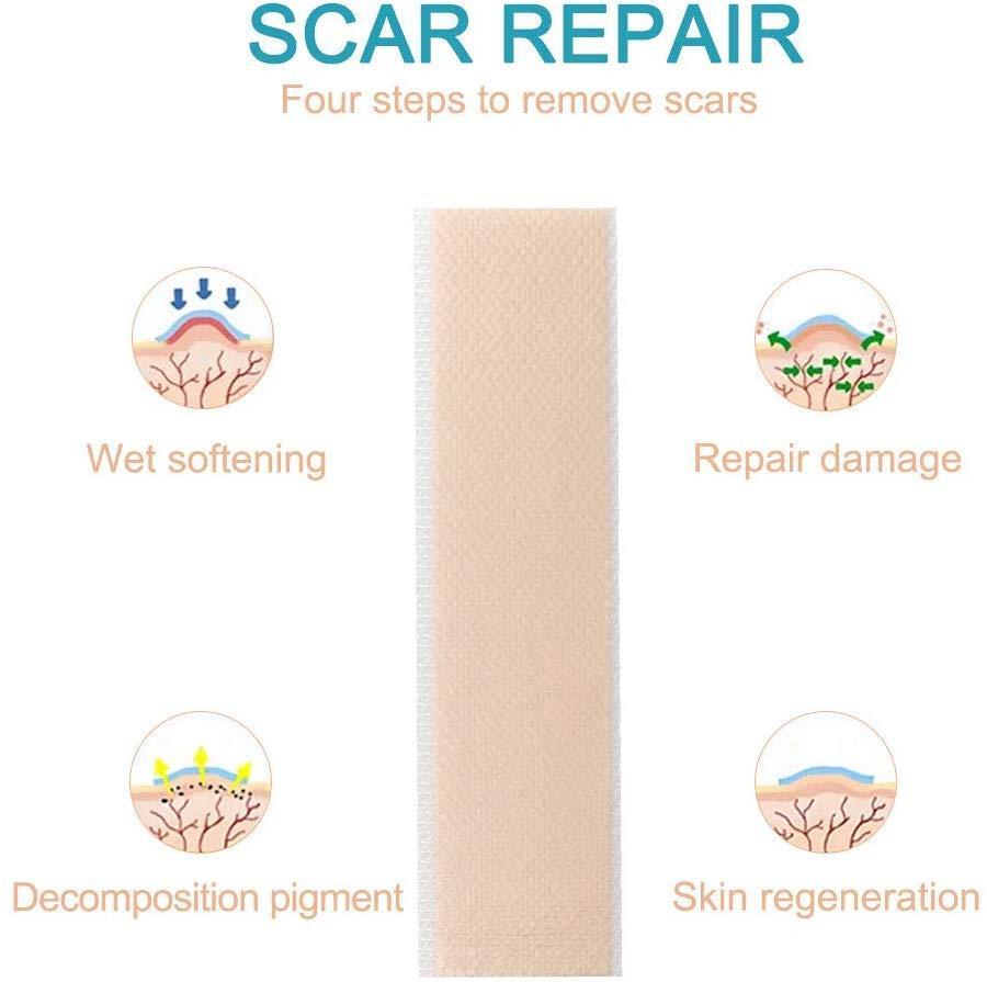 Aliver Silicone Scar Removal Treatment Sheets 4pcs