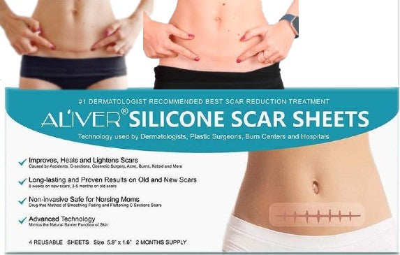 Aliver Silicone Scar Removal Treatment Sheets 4pcs