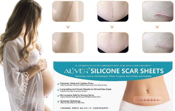 Aliver Silicone Scar Removal Treatment Sheets 4pcs