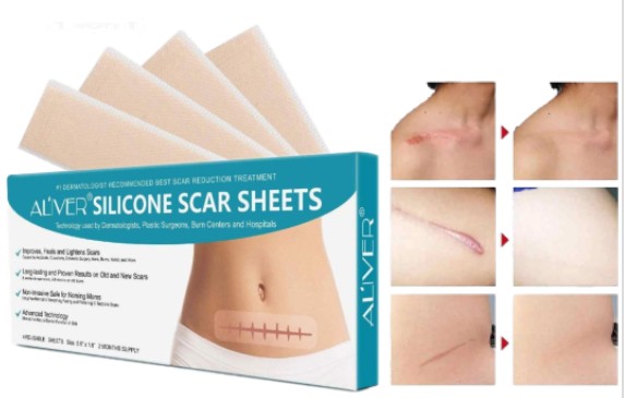 Aliver Silicone Scar Removal Treatment Sheets 4pcs