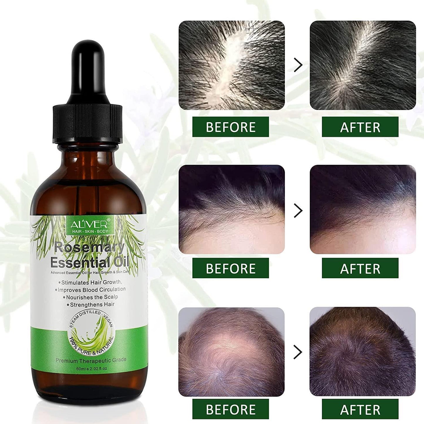Aliver Rosemary Oil for Hair Growth Strengthen Hair and Prevent Hair Loss Treatment Also Nourishes Hydrate and Soften Hair
