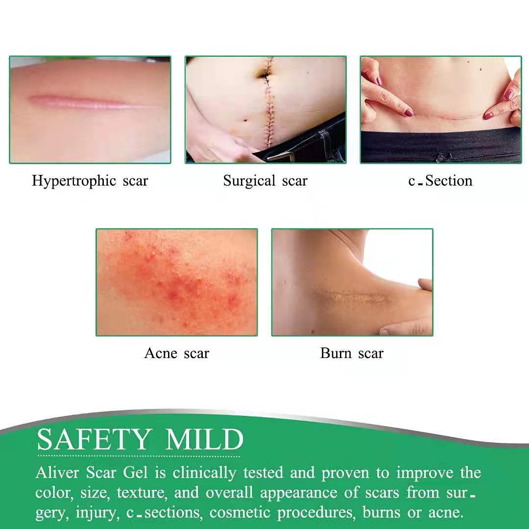 Aliver Scar Removal Treatment Tape for for Scars Caused by Surgery, C-Section, Burns, Acne, Keloid and Stretch Marks