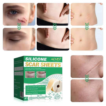 Aliver Scar Removal Treatment Tape for for Scars Caused by Surgery, C-Section, Burns, Acne, Keloid and Stretch Marks