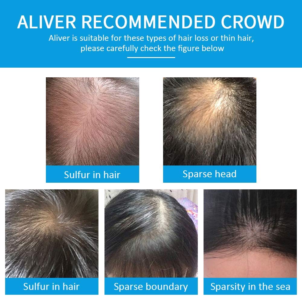 Aliver Hair Building Fibers, Natural Keratin Hair Powder Spray for Men and Women