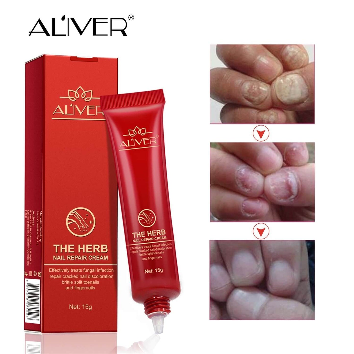 Aliver Herb -Premium Fungal Nail Treatment Powerful Anti Fungal Nail Infection Solution Cream