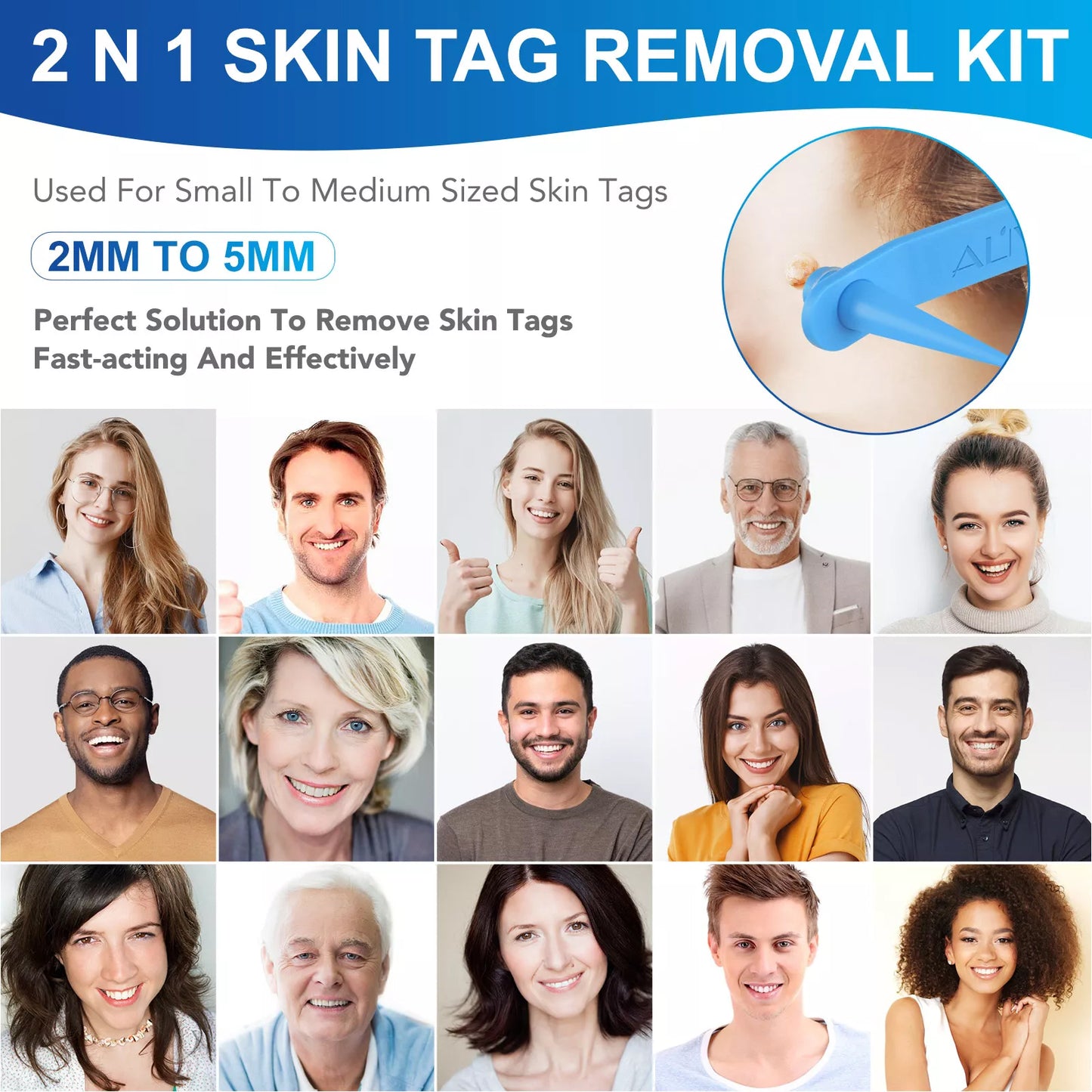 Aliver Skin Tag Remover Kit Painless Mole & Wart Removal Tool