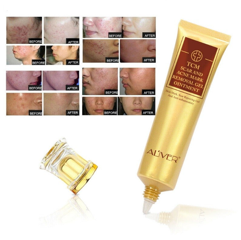 Aliver Acne Treatment & Scar Removal Cream